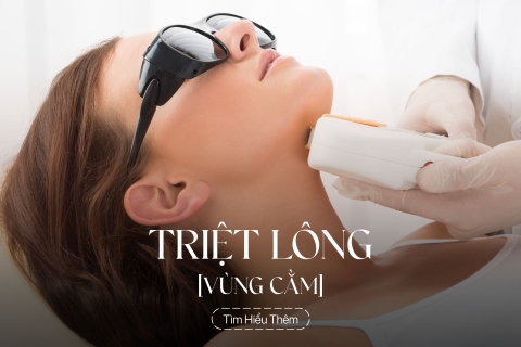 Triệt lông vùng cằm